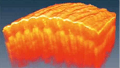 OCT Optical Coherence Tomography