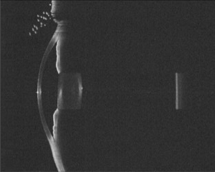 光学断層測定器　眼科イメージ